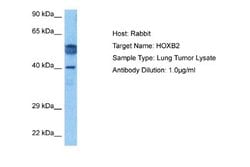 HOXB2 Rabbit anti-Human, Polyclonal, Novus Biologicals 0.1 mL | Buy Online | Novus Biologicals | Fisher Scientific